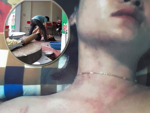 Phát hiện chồng ngoại tình, người phụ nữ đau đớn tột cùng khi còn bị chồng hành hung, mẹ chồng đuổi ra khỏi nhà cùng con gái 4 tuổi