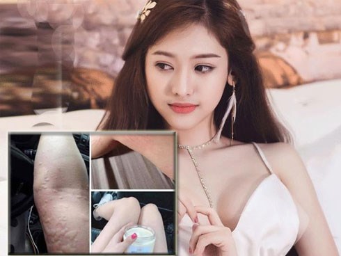 Bị tố bán kem trộn đểu, Thúy Vi lên tiếng dằn mặt: 'hà cớ gì đạp đổ miếng cơm của người khác'