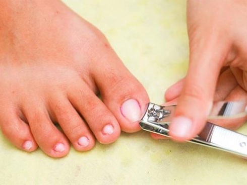 Chàng trai tử vong sau khi cắt móng chân, bác sĩ nói “nếu làm sớm điều này thì đã sống”