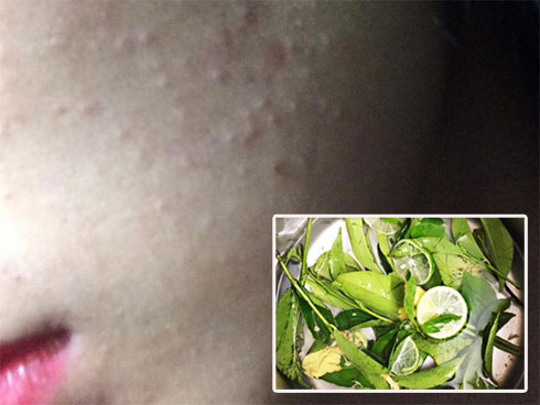 5 công dụng tuyệt vời biến trà xanh thành món dưỡng da chân ái của các chị em-6