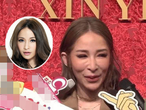 Gương mặt phu nhân cựu Thủ tướng Malaysia biến dạng vì thẩm mỹ-6