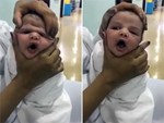 10 phút sau khi tắm, con gái 3 ngày tuổi đột nhiên co giật sùi bọt mép, mẹ đưa con vào bệnh viện thì phát hiện nguyên nhân rùng rợn-5