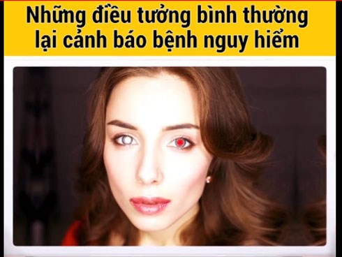 8 dấu hiệu tưởng bình thường lại cảnh báo bệnh nguy hiểm