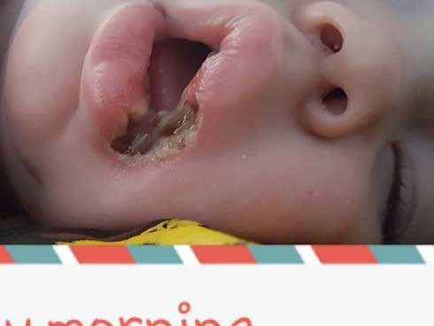 Hình ảnh đáng sợ nhắc nhở bố mẹ đừng bao giờ quên rút sạc điện thoại
