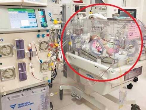 Bác sĩ nói gì về việc dùng kim châm vào đầu trẻ sơ sinh cho chảy máu để con ăn khỏe, nhanh lớn-3