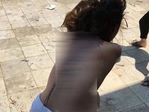 “Kiều nữ” nghi bị đánh ghen lột quần áo, cắt tóc và đổ mắm tôm lên người tại Hà Nội