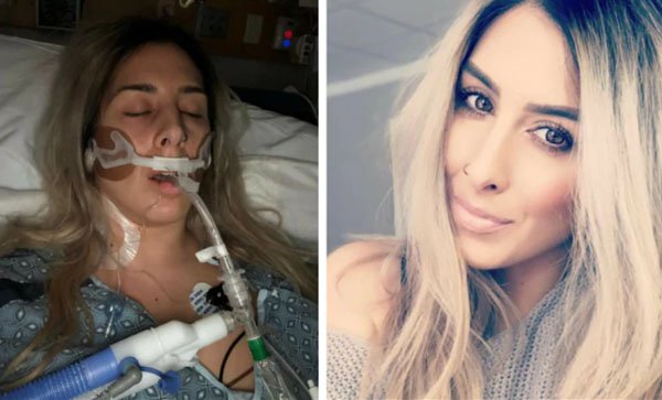 Dùng băng vệ sinh sai cách, thiếu nữ 16 tuổi bị sốc độc rồi tử vong-3