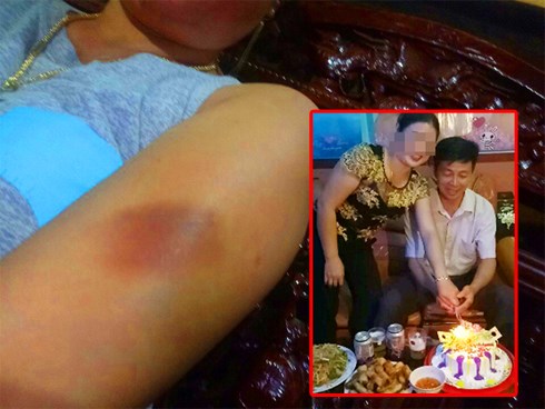 Trưởng công an xã bị tố quan hệ bất chính và hành hung “người tình”