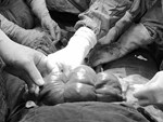 Hưng Yên: Sản phụ vỡ tử cung vì đẻ con tại nhà-2