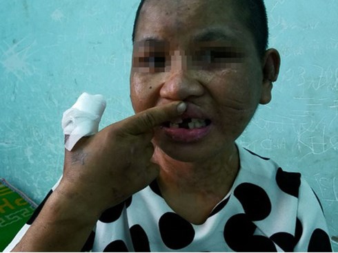 Vụ hành hạ dã man người làm công: Cứ 