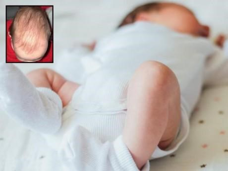 Bé 3 tháng thóp phồng to dẫn đến tử vong, BS lắc đầu 