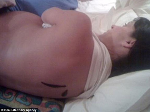 Con đỉa sống 3 tháng trong mũi người đàn ông-2