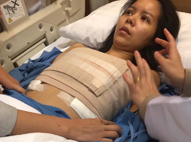 Ca sĩ Thái Lan kiện bệnh viện Hàn Quốc vì suýt chết sau ca nâng ngực-1