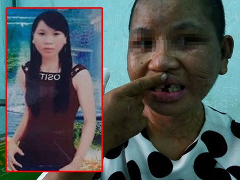 Trước lúc bị nhục hình, Y Nhiêu là một hoa khôi xinh đẹp của làng