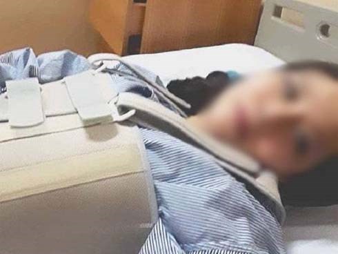 HY HỮU: Cô gái Hà Nội vỡ đốt sống lưng sau một tiếng ho?