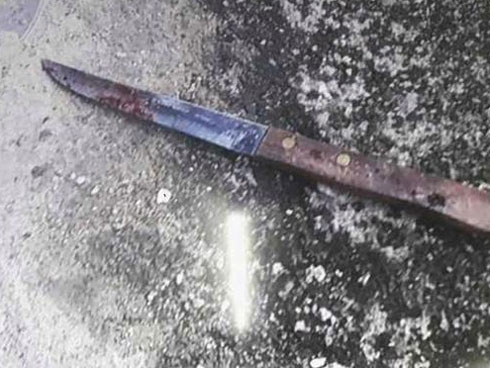 Bỏ quên cuộn dây cước câu cá vào của quý suốt 11 năm-3