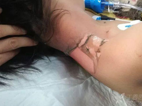 Rùng mình với tổ chấy hàng nghìn con tranh nhau làm tổ trưởng trên đầu bé gái-4