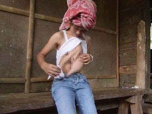 Mẹ không khám khi mang thai, con gái có