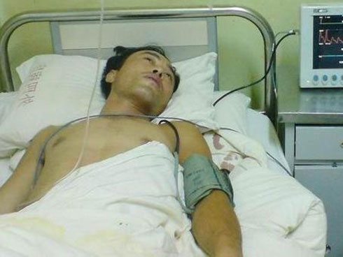 5 yếu tố lớn nhất có nhiều khả năng gây ung thư gan: Dù bạn ở lứa tuổi nào cũng nên tránh-5