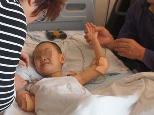 Bé 5 tuổi bị chảy máu dạ dày vì mẹ cho ăn khoai lang chung với thực phẩm này