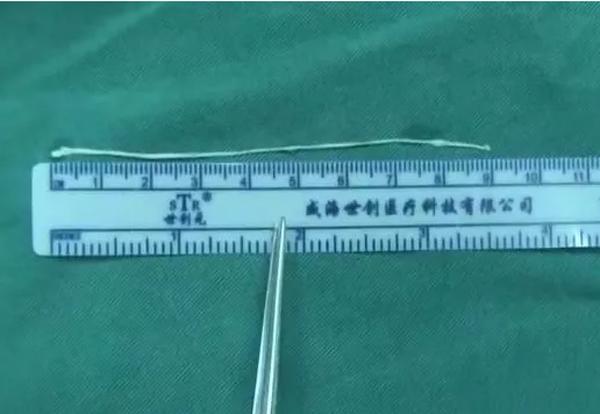 Con gái 6 tuổi bỗng bị co giật, cha mẹ tưởng chuột rút nhưng 12 năm sau mới tá hỏa-2