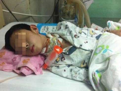 Ăn thứ quả đang vào mùa lúc đói, bé trai ổ bụng phình to, tắc ruột