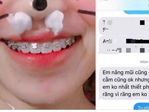 Sau khi làm đẹp cười với người yêu một cái thế là... mất luôn bạn trai