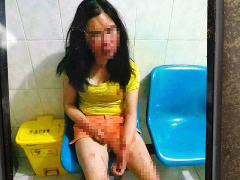 Con dâu đột ngột qua đời, hàng xóm nghi ngờ bố mẹ chồng bạo hành, bắt chồng báo cảnh sát