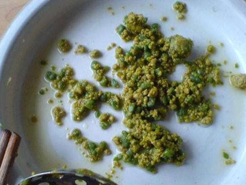 Cảnh báo: Nghe lời đồng nghiệp ăn kiểu này để giảm cân, người phụ nữ bị 200 viên sỏi trong túi mật