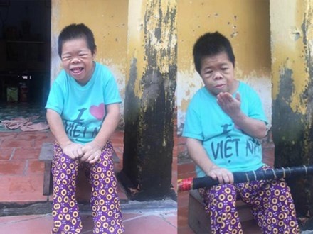 'Cô gái Sọ Dừa' mang hình hài trẻ 4 tuổi: Người mẹ vẫn chờ đợi, con cứ mãi ngây ngô