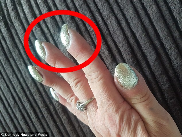 Nếu móng tay quặp vào kỳ lạ như người phụ nữ này, bạn nên nhanh chóng đi khám bác sĩ vì đó là dấu hiệu căn bệnh tử thần-2