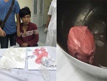 Chuyện khó tin: 12 giờ 'giải cứu' cục ma túy giấu trong vùng kín Chuyện khó tin: 12 giờ 'giải cứu' cục ma túy giấu trong vùng kín