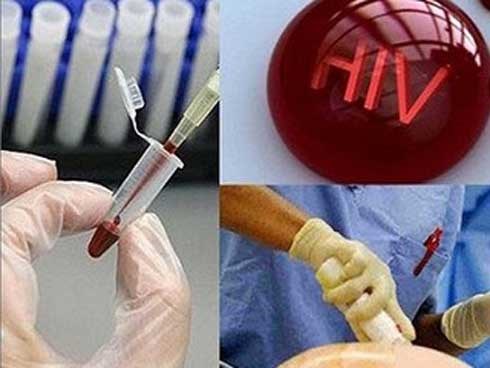 42 người nhiễm HIV ở Phú Thọ: Khi nghi ngờ phơi nhiễm HIV nên làm thế nào?