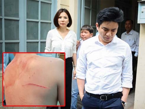 Bất ngờ kế hoạch 'đen' phía sau vụ truy sát bác sĩ Chiêm Quốc Thái