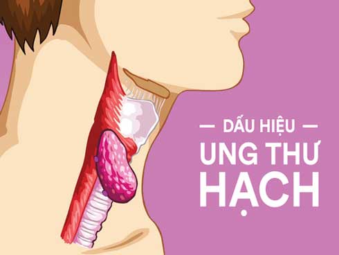 Cẩn thận nếu thấy cục hạch sau tai vì nó có thể là dấu hiệu của nhiều bệnh nguy hiểm, bao gồm cả ung thư-5