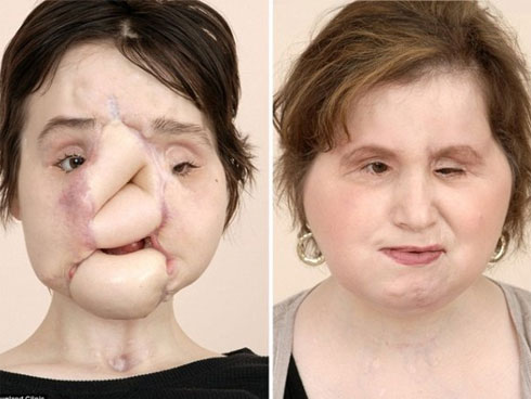 Bác sĩ khâu tay người đàn ông vào dạ dày và cái kết bất ngờ-6