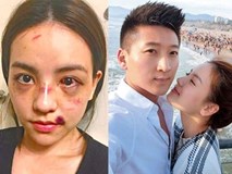 Để hụt ngôi Hoa hậu vì mang tiếng giật chồng, bị đánh bầm dập trên truyền hình, giờ đây người đẹp này sắp thành phu nhân nhà giàu Để hụt ngôi Hoa hậu vì mang tiếng giật chồng, bị đánh bầm dập trên truyền hình, giờ đây người đẹp này sắp thành phu nhân nhà giàu
