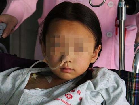 3 món ăn nhiều trẻ Việt thích khiến cô bé 10 tuổi mắc ung thư tuyến giáp