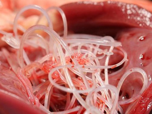 Bác sĩ lôi ký sinh trùng 15cm trong não bé trai, cảnh báo thói quen xấu khi ăn uống-4