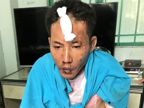 Hai bé gái bị cha dượng tưới xăng thiêu sống đã tử vong