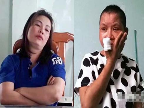 Thông tin mới vụ cô gái giúp việc 9X bị chủ hành hạ đến biến dạng, sảy thai-2