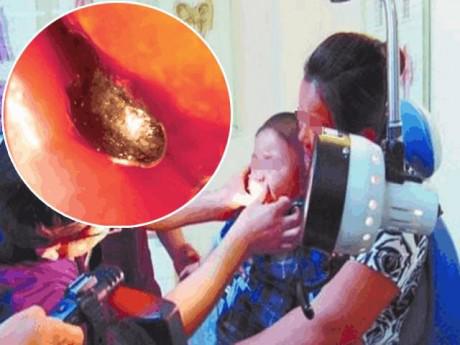 Cậu bé 2 tuổi chảy máu cam, người mẹ sai lầm trong cách sơ cứu khiến con trai tử vong ngay lập tức-3