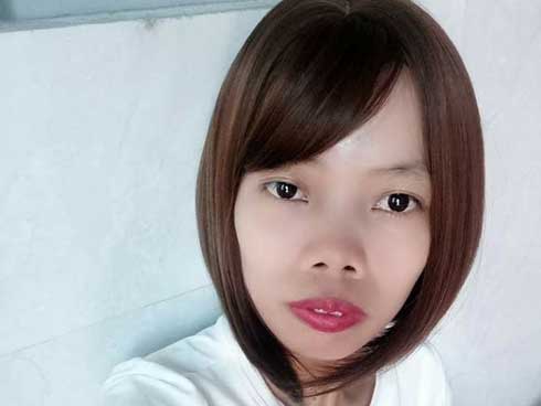 Chi 160 triệu và cả tháng trời không thể đánh răng: Câu chuyện về chàng trai trẻ PTTM vì nỗi tự ti mặt vuông gây sốt cộng đồng mạng-7