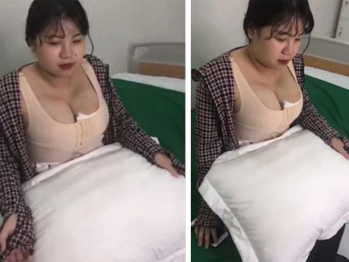 Hình ảnh mới của cô gái siêu vòng 1 Hải Dương sau phẫu thuật thu nhỏ ngực, tiết lộ giảm 1kg mỡ mỗi bên