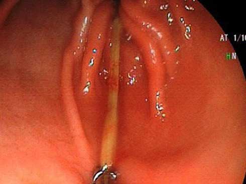 Vừa uống nước vừa xỉa răng và cái kết quằn quại-2