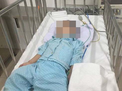 Bé 5 tuổi bị bạn trai của chị họ đánh chấn thương sọ não