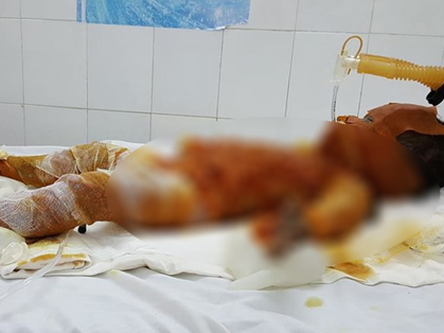 Người đàn ông đốt rác ngay gốc cây-1