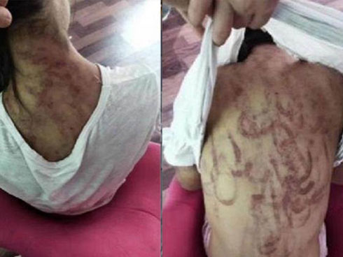 Sốc: Bé trai 8 tuổi bị bố và mẹ kế ép ăn chất thải đến chết sau nhiều năm bị bạo hành dã man-6