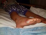 Ngón tay và ngón chân của người ông này bỗng chuyển sang màu đen sì - dấu hiệu cảnh báo bệnh nguy hiểm-6