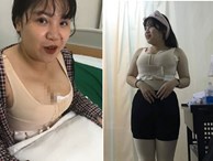 Nữ sinh 'siêu vòng 1' bất ngờ xuất hiện với thân hình eo ót sau khi hút 9 lít mỡ thừa
